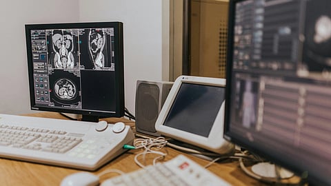 Medical workstation displaying CT scan images on dual monitors.