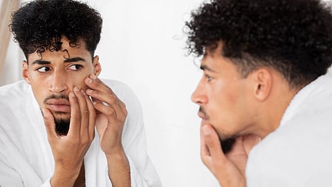 A young man looks at his reflection in a mirror, checking his face with concern.