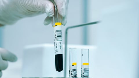 Gloved hand holding a labelled blood collection tube in a clinical laboratory setting