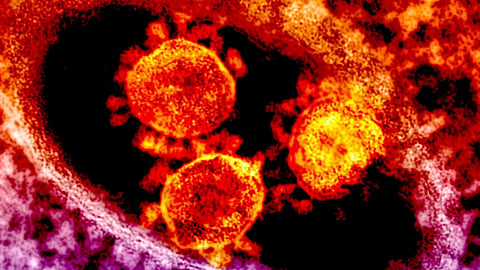 Microscopic view of pathogens linked to excessive immune activation and life-threatening sepsis.