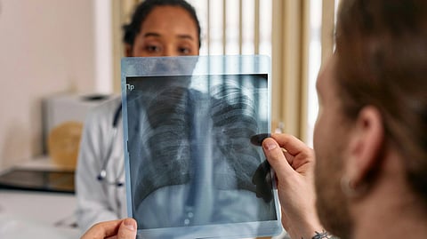 A man holds an x-ray image of a chest.