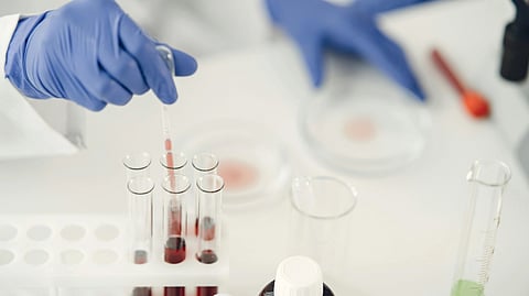 A person in a lab coat holds a test tube, focused on their experiment in a laboratory setting.