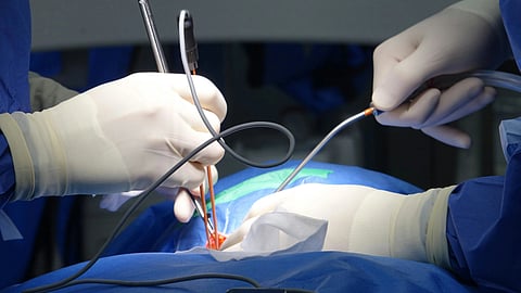Doctor’s hand performing bronchoscopy in a clinical setting representing emergency airway treatment in a pediatric foreign body aspiration case.