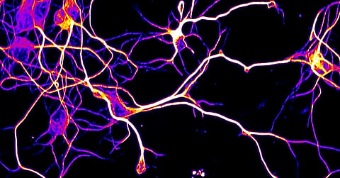 Fluorescence microscopy image of neuronal axons