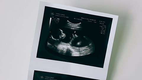 A close-up of a baby visible on an ultrasound screen.