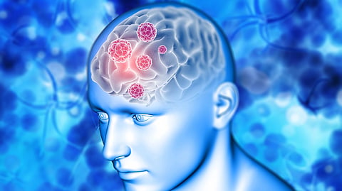 A digital illustration of a human head in profile with a visible brain.