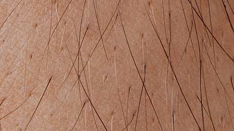 Close-up of a man's hairy legs.