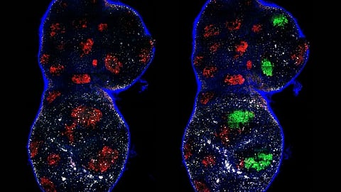 Two cells displaying green and red spots.