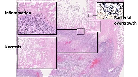 Diagram depicting various skin stages.
