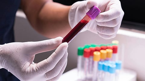 Lab technician handling colour-coded blood collection tubes in a clinical biochemistry laboratory