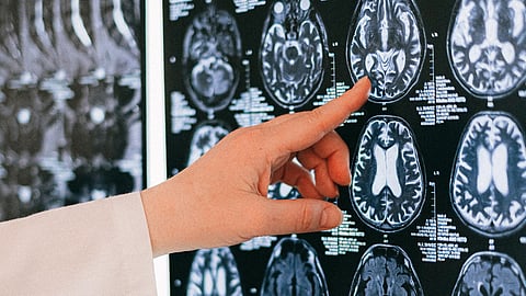 A doctor pointing at an MRI scan.