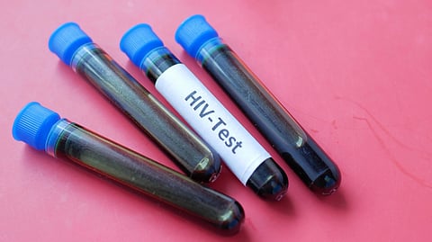 Four test tubes with blue caps, one labeled "HIV-Test," rest on a red surface.