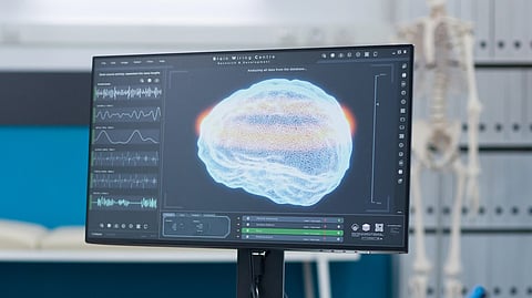 A computer monitor displaying an image of a human brain.