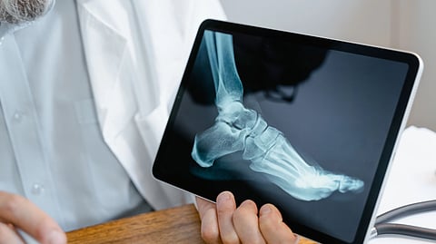 Close-up of a doctor in a white lab coat holding a digital tablet that displays a lateral X-ray of a human foot and ankle.