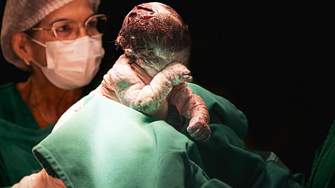 A newborn baby is held by a medical professional after delivery in a hospital setting.