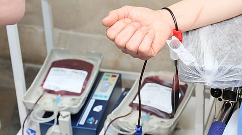 An arm attached to medical tubing during a blood donation process.
