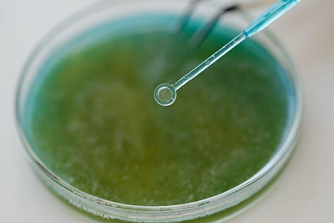 Green fungal culture growing in a petri dish with an inoculation loop lifting a sample colony