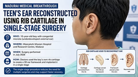 Doctors at Meenakshi Mission Hospital and Research Centre reconstructed the left ear of a 16-year-old boy with congenital microtia using cartilage harvested from his own ribs.