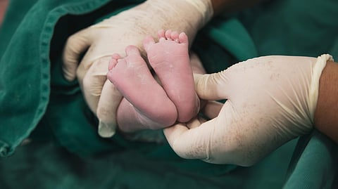 Healthcare workers holding a newborn baby's feet during a Caesarean section procedure.