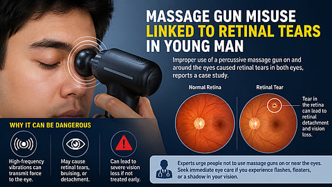 Young man in the UK developed retinal tears after using a massage gun near his eyes.