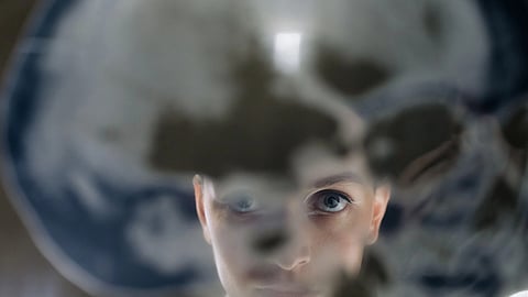 Double-exposure image of a woman with a visible skeleton overlay.