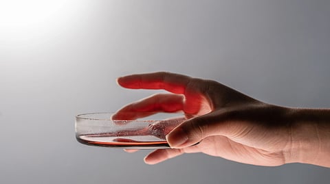 Extracted human teeth scattered on a wooden surface.