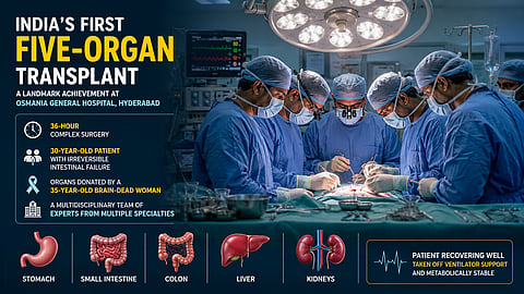 Doctors at Osmania General Hospital performed a 36-hour simultaneous five-organ transplant on a patient with irreversible intestinal failure.