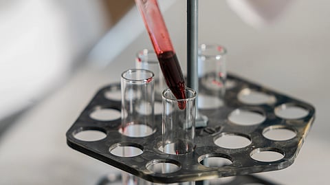 A lab pipette adds a red liquid to a test tube.