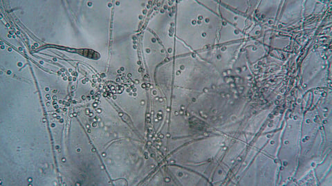 A close-up microscope view of thin, thread-like fungal strands.