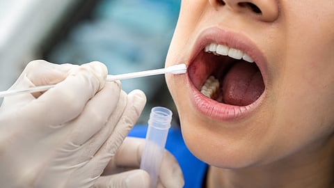 Mouth swab