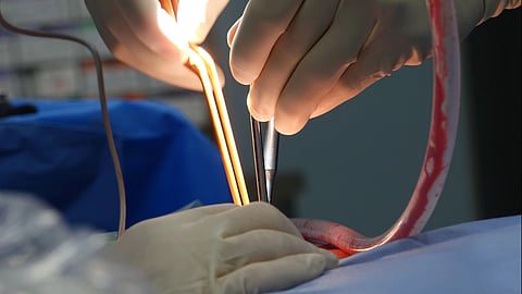 Surgeons perform a delicate operation.