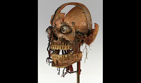 Dissected skull, Maison Tramond model, Paris, nineteenth century