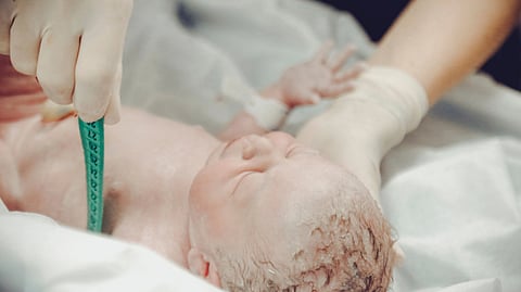 A newborn baby is measured by healthcare workers after birth.