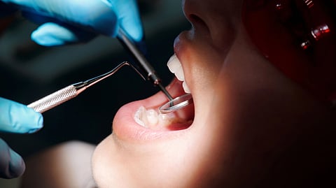 Close-up of a patient's open mouth during a dental exam under a bright light.
