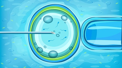 Illustration showing sperm injection into an egg during IVF treatment