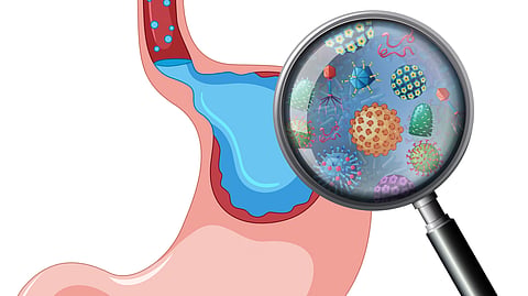 A medical illustration of a stomach with magnified disease-causing microbes.
