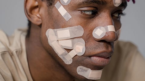 Experts warn that looksmaxxing can harm young men's health.