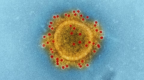 An electron microscope image of a coronavirus particle.