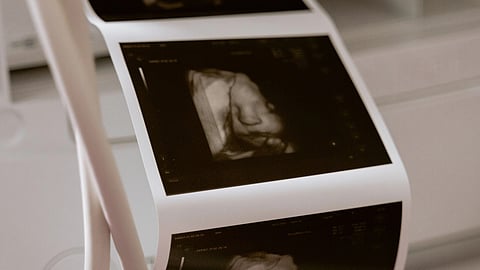 A sonography result.