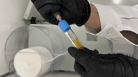 Lab technician using syringe to fill blood sample tube, showcasing medical testing procedure.