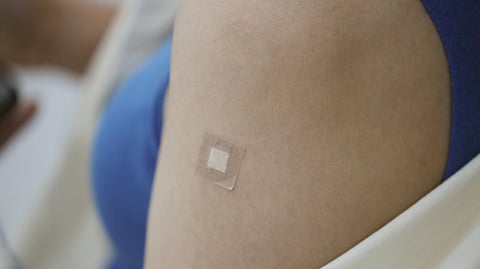 A microneedle patch sticking to a person's arm.