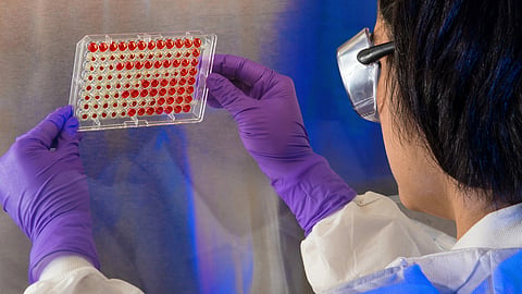 Scientist reviewing blood samples