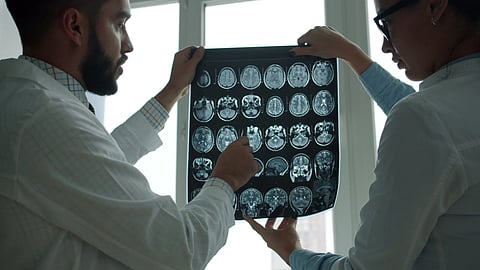 Doctors reviewing a brain MRI