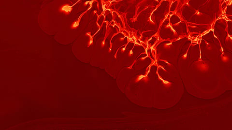 Section of brain with nerve like elements