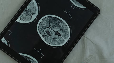 Brain scan 