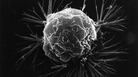 scanning electron microscopy image of a cancer cell
