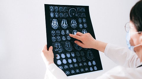 Doctor going through a brain MRI scan