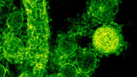 Green-tinted microscopic image of coronavirus particles illustrating viral structures