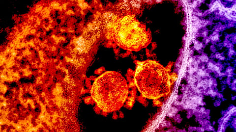 microscopic picture of virus and immune cells