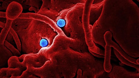 Microscopic image of macrophages